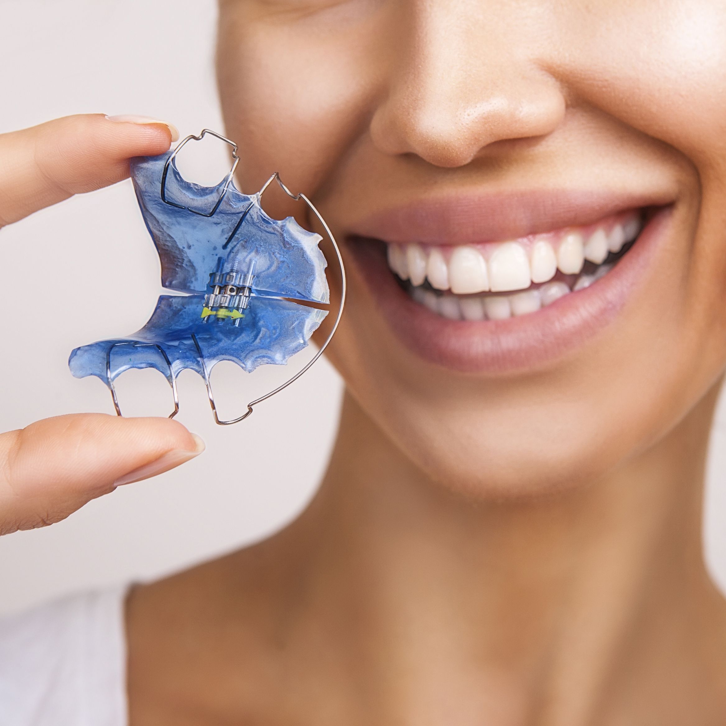 A woman holding a retainer